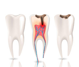 Эндодонтия